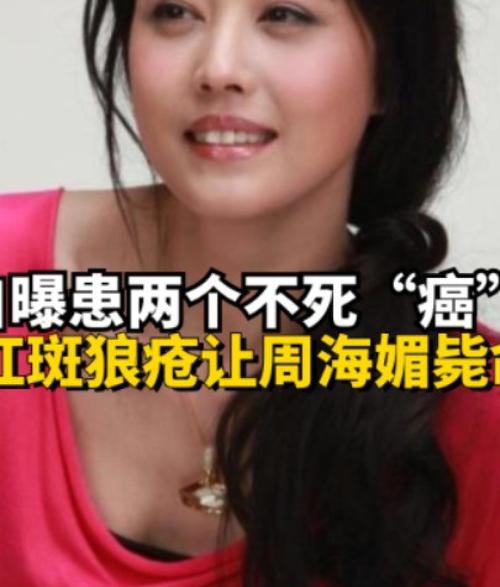 演员周海媚因病去世，困扰她多年的